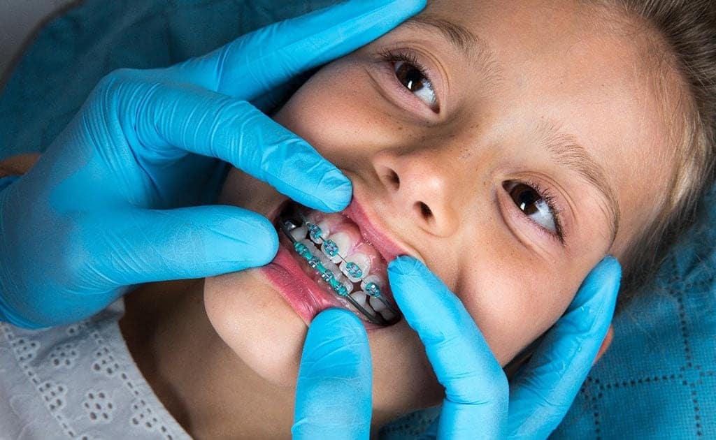 Braces for children in Waterdown