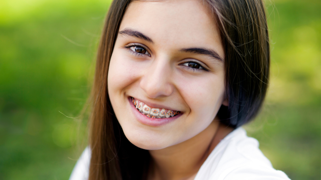 Teen smiling with braces at Viva Orthodontics in Waterdown