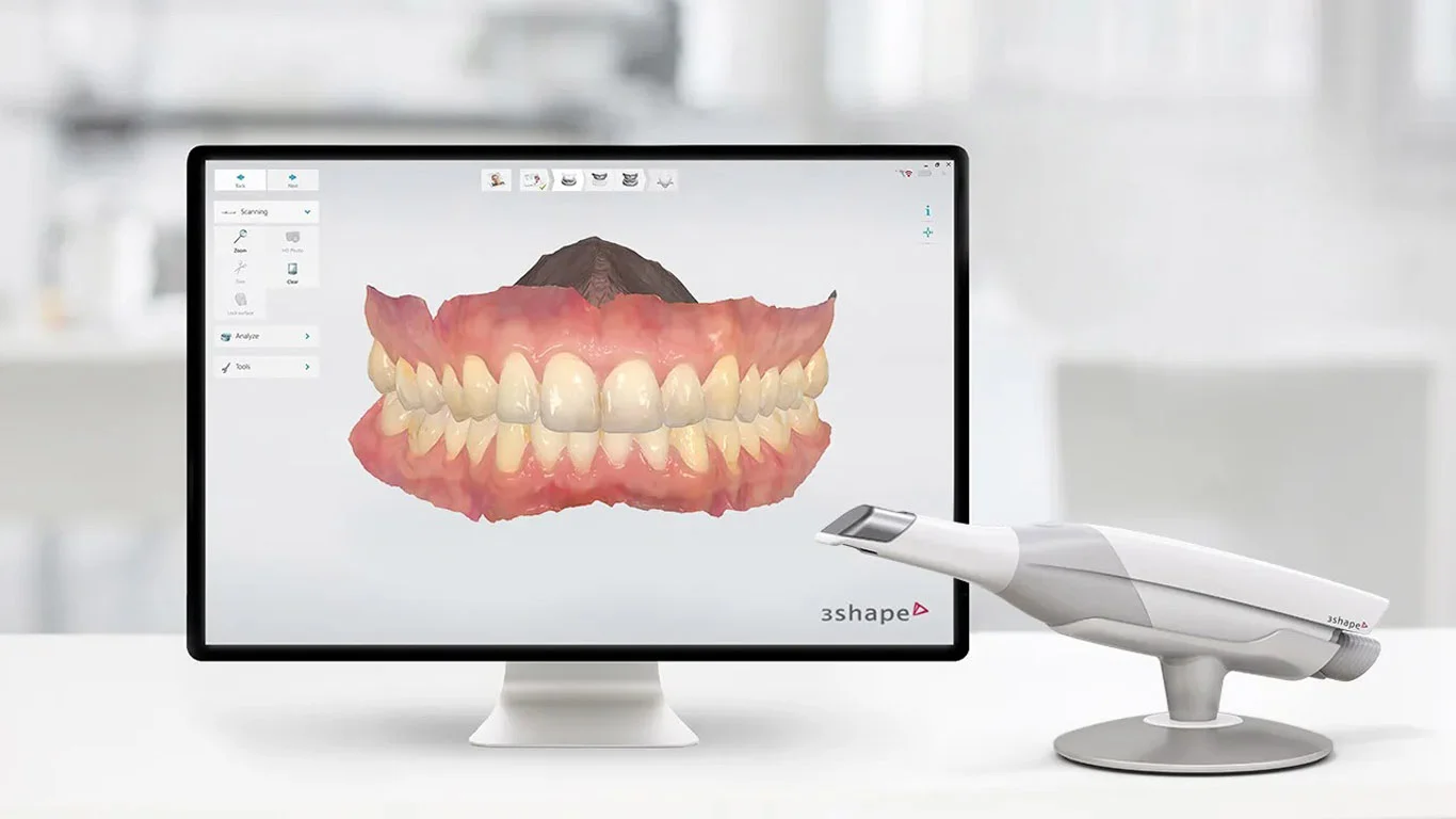 Patient with a clear aligner after a 3D scan