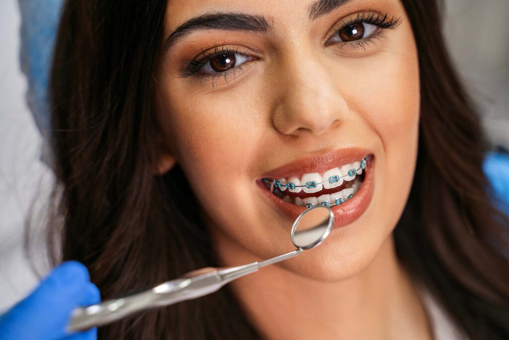 Close-up of braces being fitted at Viva Orthodontics in Waterdown