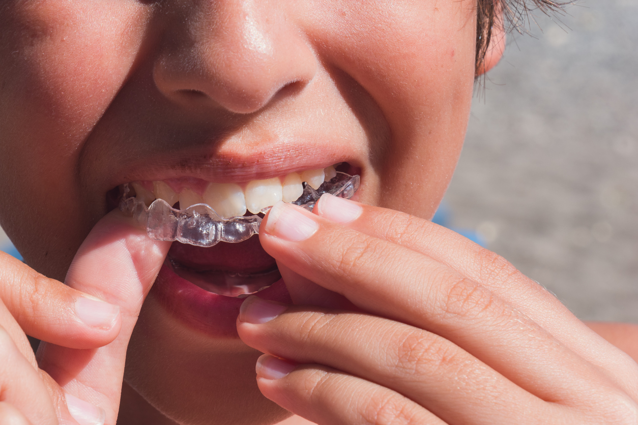 Child holding a clear Invisalign aligner in Waterdown