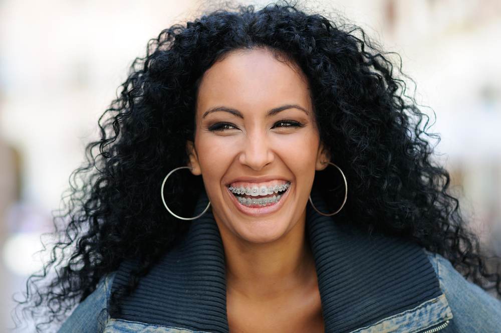 Adult orthodontics at Viva Orthodontics in Waterdown